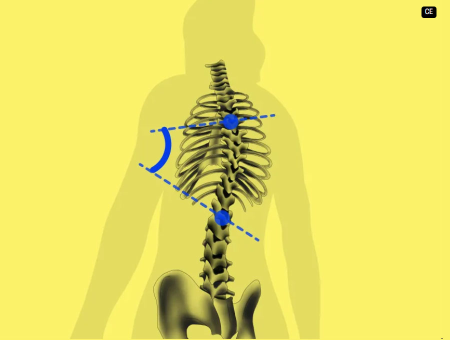 Gleamer BoneMetrics